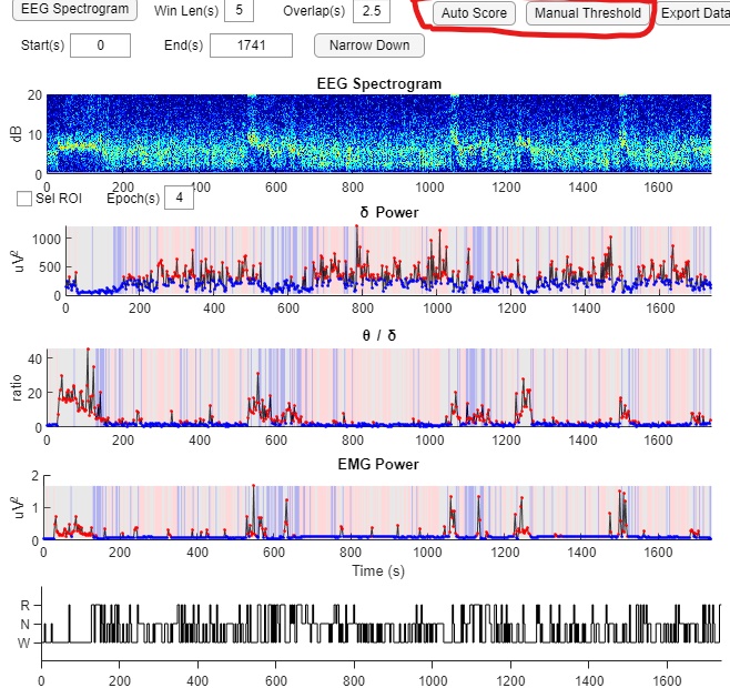 GitHub - li-shen-amy/eeg_sleep: MATLAB Code for Sleep cycle analysis ...