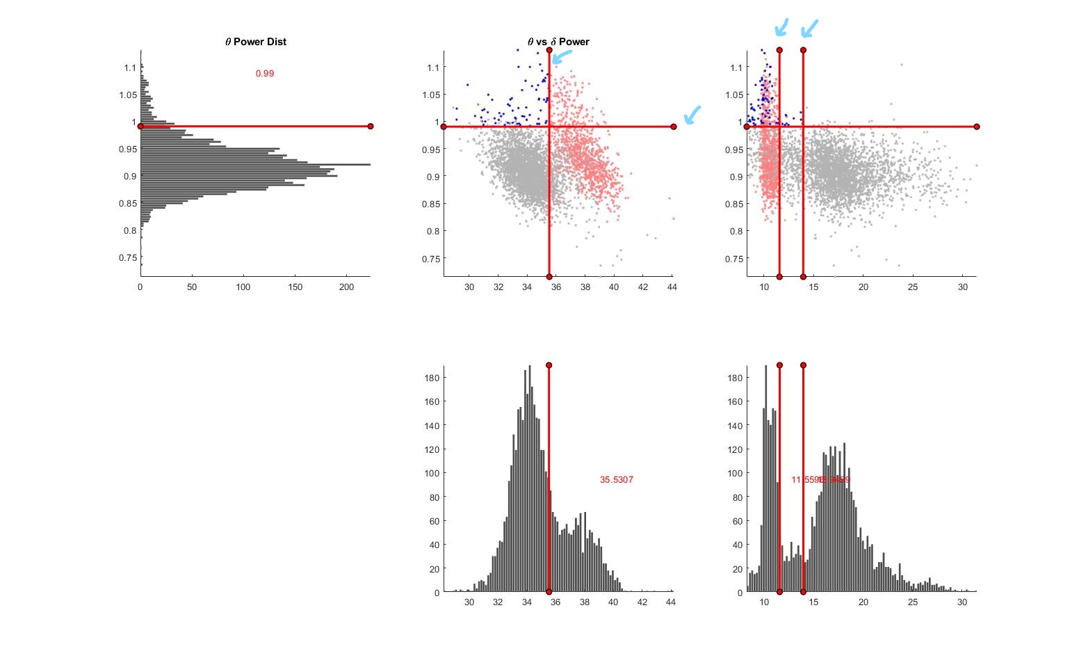 GitHub - li-shen-amy/eeg_sleep: MATLAB Code for Sleep cycle analysis ...