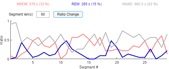 GitHub - li-shen-amy/eeg_sleep: MATLAB Code for Sleep cycle analysis ...