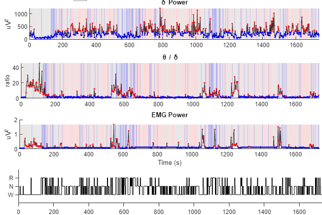 GitHub - li-shen-amy/eeg_sleep: MATLAB Code for Sleep cycle analysis ...